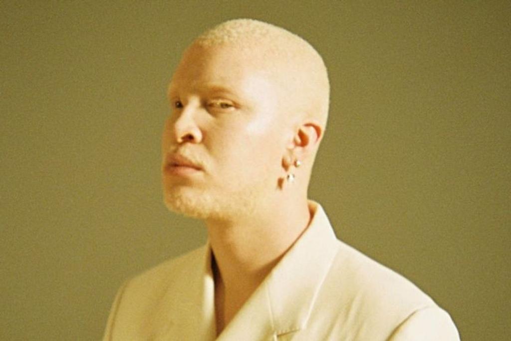 Shaun Ross Albinism Model
