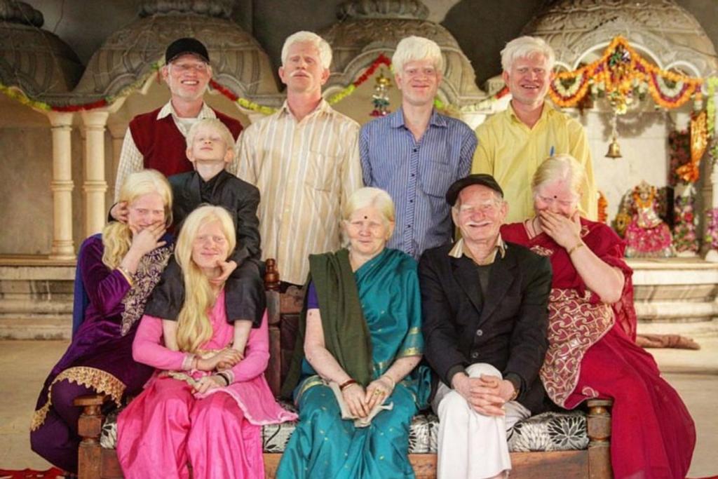 Family Albinism Beautiful Humans