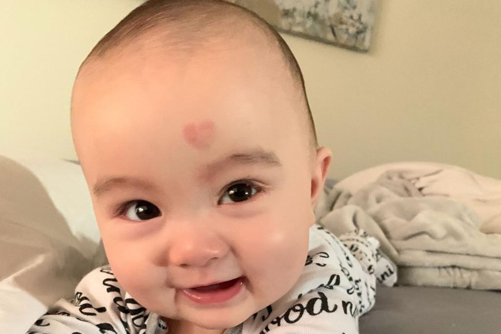 Baby Heart-Shaped Birthmark