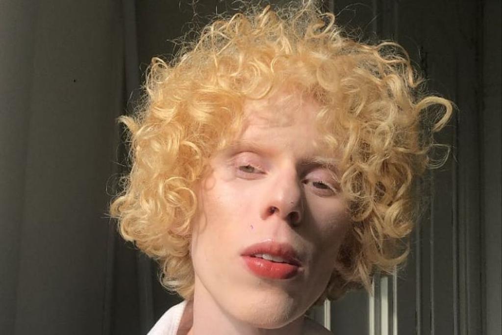 Albinism Model Genetic Mutatio