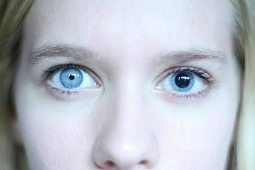 unique conditions human eyes